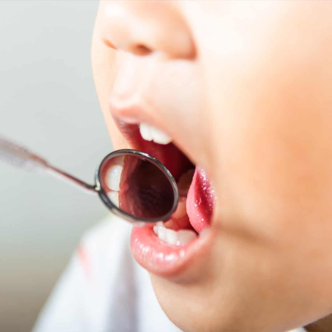 children are satisfied with the dental treatments for kids at Chattahoochee Pediatric Smiles and Airway in Marietta GA