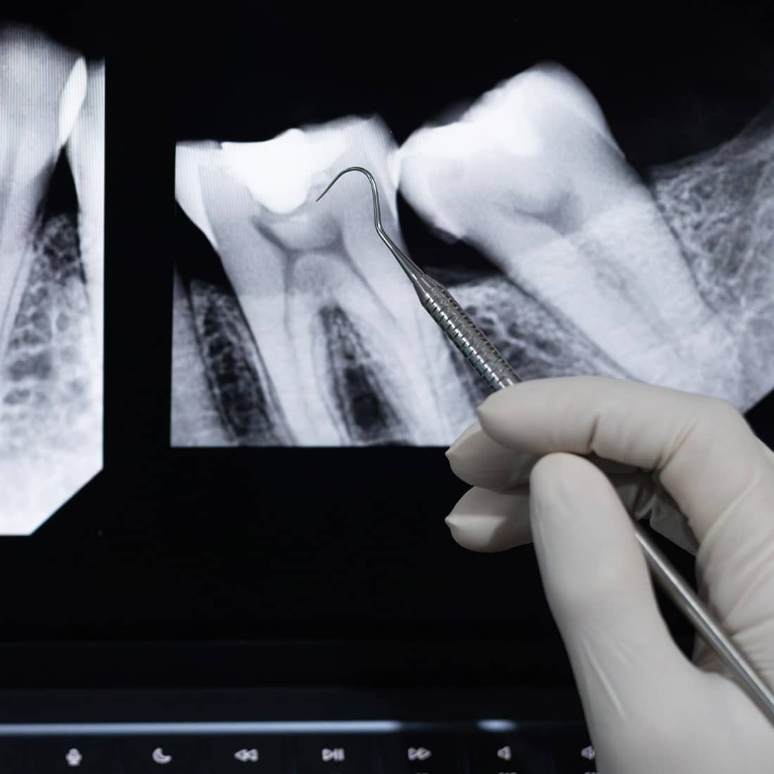 advanced dental treatments at Chattahoochee Pediatric Smiles and Airway in Marietta GA